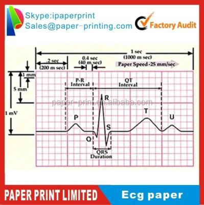 China ECG PAPER, other video printing paper 110*140,50mm*30m, 63mm*30m, 80mm*20m ECG paper for sale