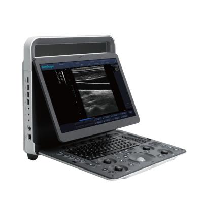 China Sonoscape E1 B/W Plastic Portable Ultrasound Machine for sale