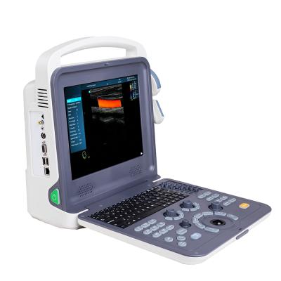 China Portable Metal Color Doppler Ultrasound Machine HUC-260 for sale