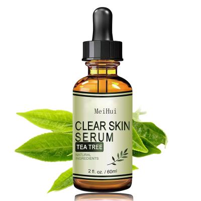 China Private Label Natural Acne Anti Aging Anti Moisturizing Tea Tree Serum for sale