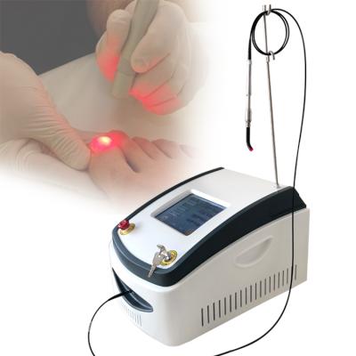 China Hot Sale Fungus Toe Nail Removal 2022 Laser For Fungus Onychomycosis Nail Treatment Machine for sale