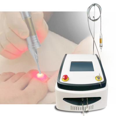 China 2020 Fungus Fungus Hot Sale Toe Nail Removal Treatment Medical Device Laser Fungus Treatment For Fungal Nail for sale