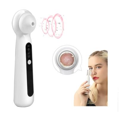 China Black Head Suction Blackhead Removal Tool Skin Acne Vacuum Blackhead Blackhead Remover for sale