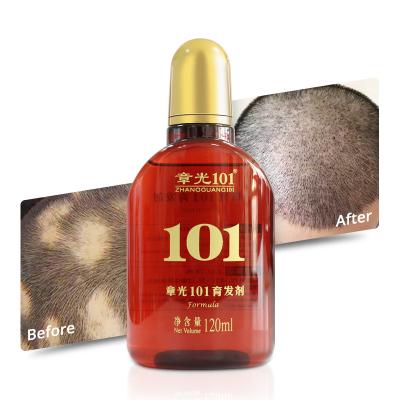 China Private Label Daily Nourish Scrape Hair Loss Treatment Hair Growth Tonic For Alopecia Areata for sale