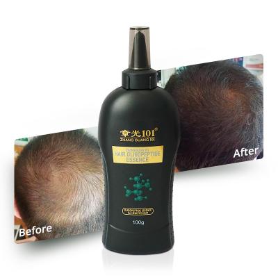 China 100% Natural Herbal Natural Private Label Organic Repair Damaged Hair Growth Oil For Businessman for sale