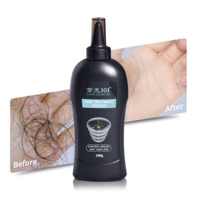 China Loss Prevention Supplier Chinese Ginseng Extracts Hair Loss Treatment Organic Oil for sale