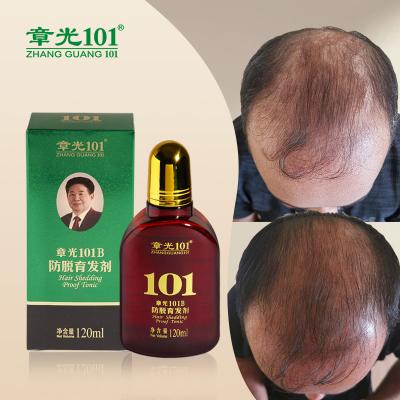 China Chinese Herbal Organic Hair Loss Prevention Private Label Hair Loss Treatment Serum for sale