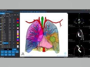 China Serviços de reconstrução 3D médica e impressão 3D à venda