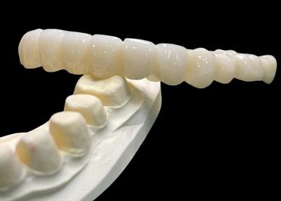 China Vita Classical Shade All Ceramic Crown Bridge Natural Looking For Dental Restoration for sale