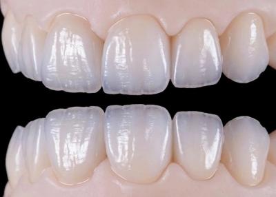 China Natural Wear Resistant Ceramic Dental Crown Bridge For Lifelike Restoration for sale