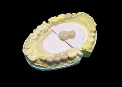 China Advanced Translucency Ceramic Crowns and Bridges Enhance Your Smile with Precision and Natural Aesthetics for Long-lasting Durability for sale