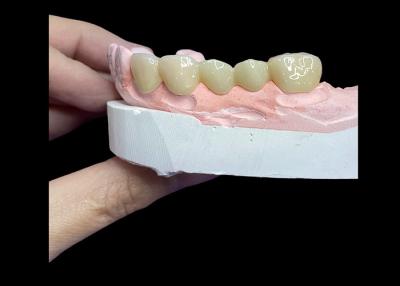 China All Ceramic Crowns and Bridges Designed for Superior Aesthetics Durability and Natural Fit for Long-Lasting Confidence for sale