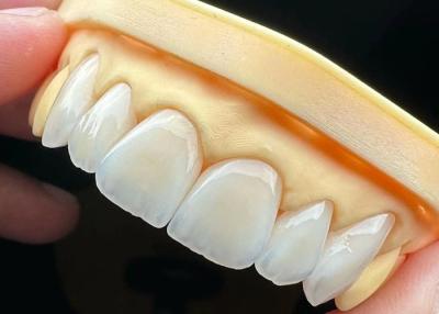 China High Strength Full Ceramic Crown Bridge with Exceptional Biocompatibility for Long-Lasting Durability for sale