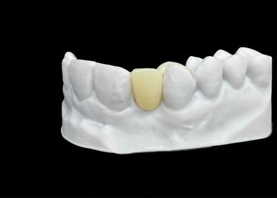 China Chipping Resistance Zirconia dental Crown With Exceptional Strength And Translucency for sale