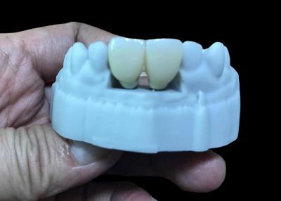 China Replace Missing Teeth Dental Implant crown With Screw Titanium Base And Zirconia Crown for sale