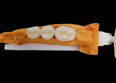 China Wear-Resistant Zirconia Dental Crown with Chip and Stain Resistance and Natural Aesthetics from China dental lab for sale