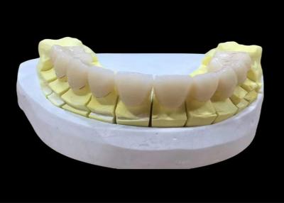 China Aesthetic Natural Looking Full Zirconia Crown , Dental Crown Material Zirconia for sale