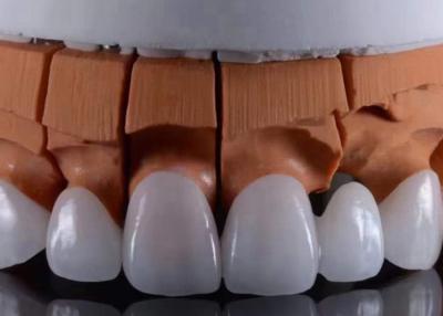 China FDA Approved Translucent Zirconia Crowns Precise Fit with Natural Aesthetic Appearance for sale