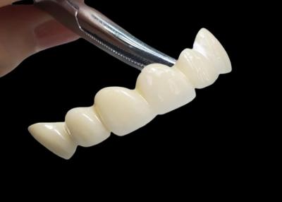 China Custom Translucent Zirconia Dental Crown With High Durability Stain Resistant for sale