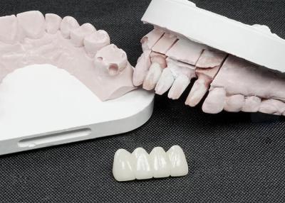 China Very Hard Natural Look Zirconia Crown For Front Teeth / Posterior Teeth for sale