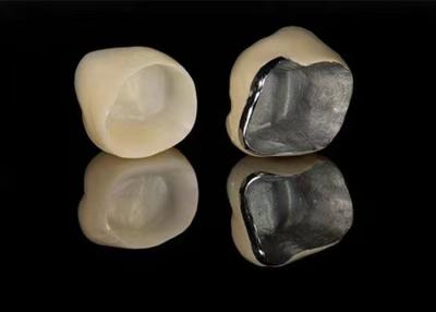 China Natural Looking Porcelain Fused To Metal Crown For Restoring Damaged Teeth for sale