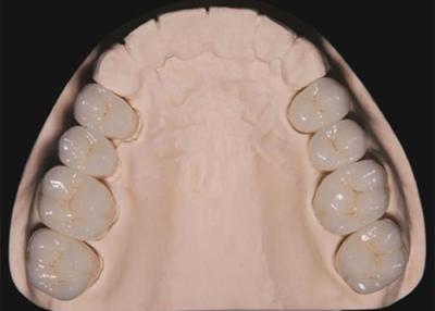 China Dental Restoration Teeth Zirconia Crowns , Long Lasting Tooth Crown Made Of Zirconia for sale