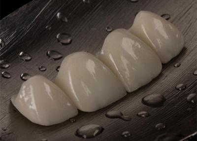 China Customizable Size Ceramic Crown Bridge For Missing Tooth Comfortable Perfect Fit for sale