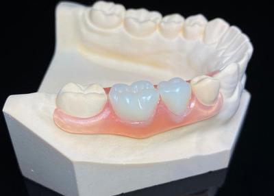 China OEM Invisible Removable Dentures Custom Acrylic Resin Partial Dental Prosthesis for sale