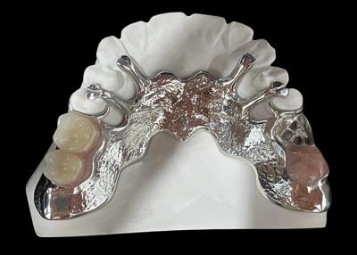 China Customizable Cast Partial Removable Denture With Acrylic Resin / Metal Base Design for sale