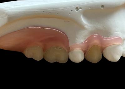 Chine Dentures flexibles invisibles réglables: confortables pour mâcher et parler avec une durabilité variable à vendre