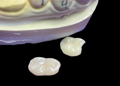 China Custom Ceramic Dental Inlays And Onlays Wear Resistance Comfortable Surface for sale