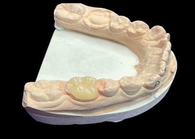 China Custom Smooth Dental Ceramic Inlay Tooth Staining Resistant Seamless Teeth Repair for sale