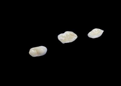 China Inlays e onlays cerâmicos biocompativeis concebidos para uma durabilidade confortável e integração perfeita com os dentes naturais à venda