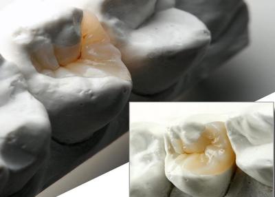 China Natural Looking Dental Lab Ceramic Inlay And Onlay For Precise Dental Restoration for sale