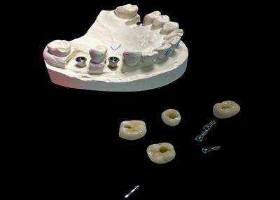 China Polished Surface Dental Implant Screw Retained Crown For Tooth Replacement for sale