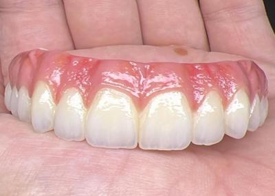 China Oral Health Zahnimplantat Unterstützte Zahnprothesen Brücke Polierte Oberfläche Unterstützende vollständige Zahnprothesen zu verkaufen