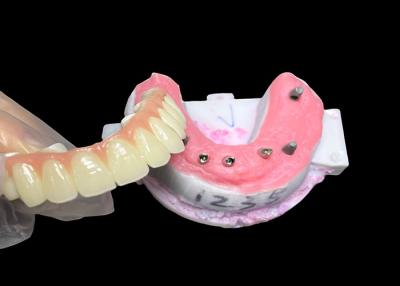 China Full Arch Denture Fixed Dental implant Ceramic Crown Bridge with Titanium Base for dental restoration for sale