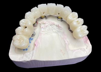 China Full Arch Dental Implant Crowns and Bridges Restoring Function and Aesthetics with Advanced Solutions for sale