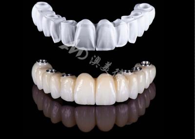 China Affordable Precise Full Zirconia Crown , High Strength Zirconia Dental Crown for sale