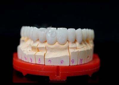 China Precise Fit Full Zirconia Crowns , Highly Biocompatible Zirconia Crowns For Teeth for sale