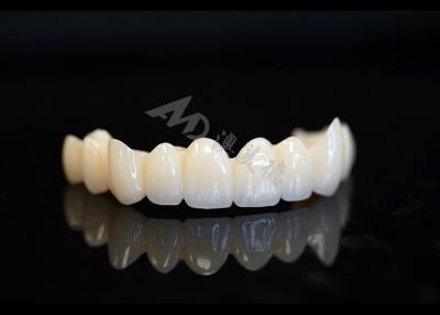 China Precision Made Solid Zirconia Crown For Perfect Dental Fit And Comfort for sale