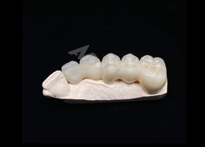 China Translucidez Estética natural Coroa de zircônio sólido para dentes Resistente a quebra à venda