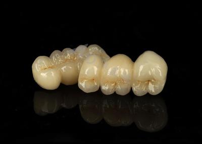 China Stain Resistant Solid Zirconia Crown Combining Excellent Bio Compatibility for sale