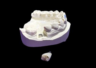 China Dental Implant with Ceramic Crown and titanium Abutment for molar for sale