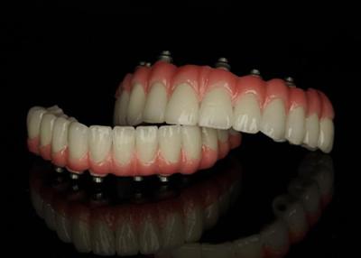 China Titanium Base  Fixt Implant supported dentures with Ceramic Crown Bridge For Replacing Missing Teeth for sale