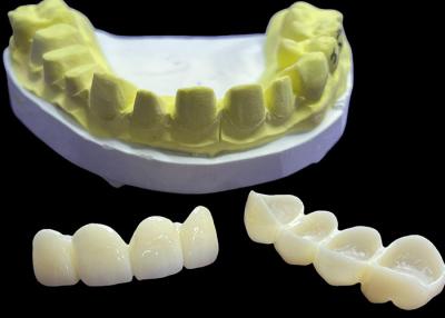 China Stain Resistant Dental Porcelain Crowns and Bridges in Vita Classical Shades for Natural Aesthetics for sale