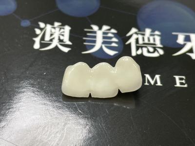 China Precise Fit Ceramic Crown Bridge Strength Porcelain Crown Natural Aesthetic Translucency for sale