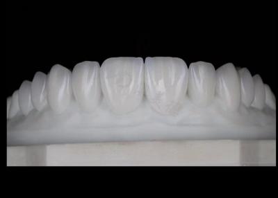 China Translucidez Natural Estética Coroas de Zirconia Excelente Biocompatibilidade E Força à venda