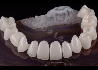 China Translucent Dental Tooth Solid Zirconia Crown Natural Aesthetics Chipping Resistance for sale