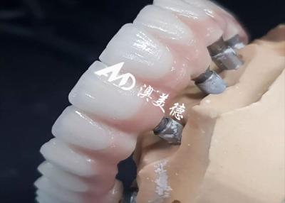 China Exclusive High Performance Dental Implant Crown Bridge Various Sizes Available for sale